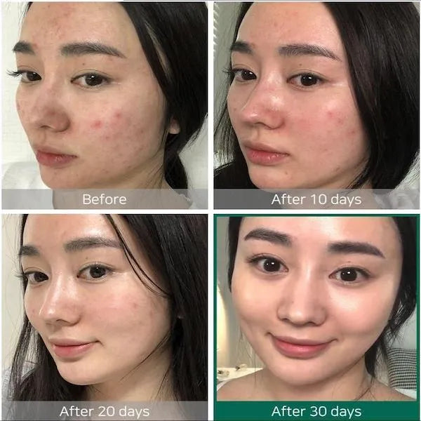 SOMEBYMI - AHA BHA PHA 30 Days Miracle Toner - 150 ml SOMEBYMI