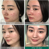 SOMEBYMI - AHA BHA PHA 30 Days Miracle Toner - 150 ml