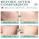 Bioaqua Salicylic Acid Cleanser